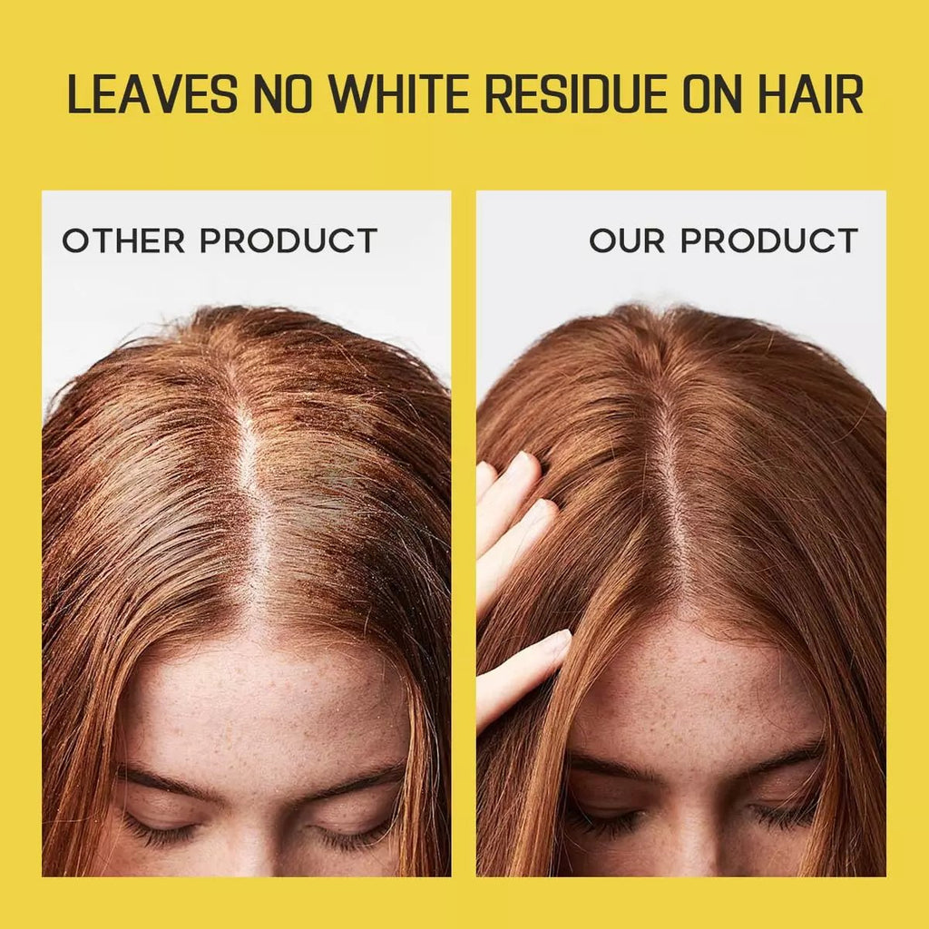 🔥2025 New Arrival🔥INSTANT FRESH VOLUMZING HAIR DRY SHAMPOO